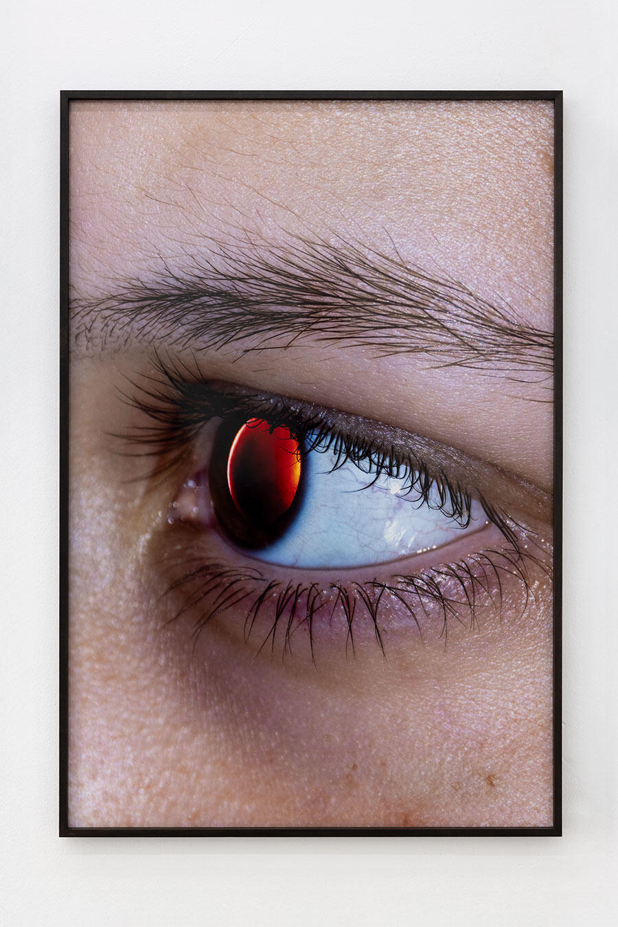 simon-dybbroe-moller-retinal-rift-2025